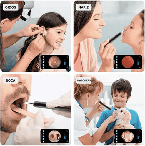 NatEar HD™ Limpia tus oídos con precisión y de forma segura en minutos